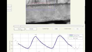 Zebrafish blood flow evaluation using a microscope- MicroZebraLab