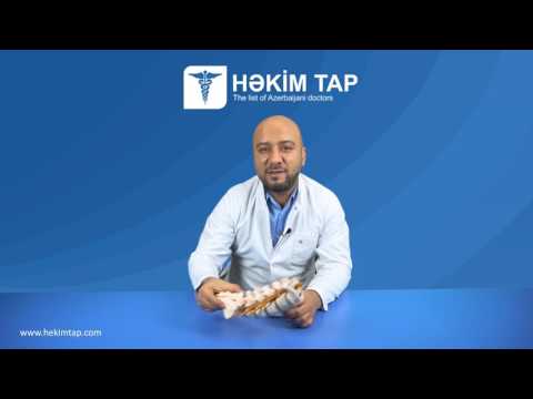Onurğa sağlamlığı. Bel yırtığı və onun səbəbləri - Neyrocərrah Op. Dr. Gökhan Serbes