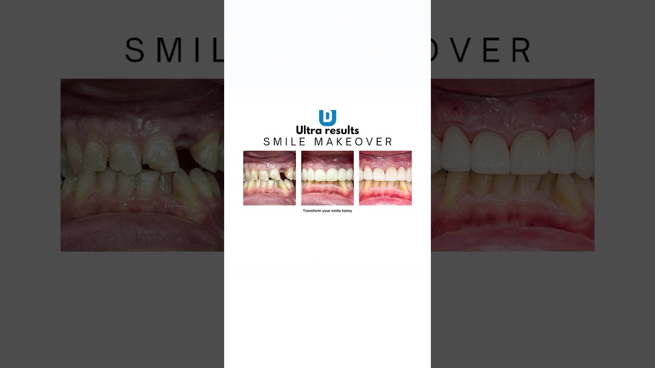 Arizona’s home of the smile makeover