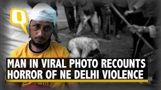 Delhi Violence: ‘Mob Saw My Cap, Beard & Pounced At Me,' Says Man in Viral Photo | The Quint