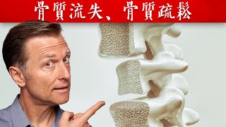 骨質疏鬆、骨質流失,缺少一種微量礦物質,骨骼的營養素,柏格醫生 Dr Berg