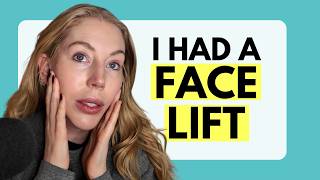 I HAD A FACELIFT IN MY 40's...