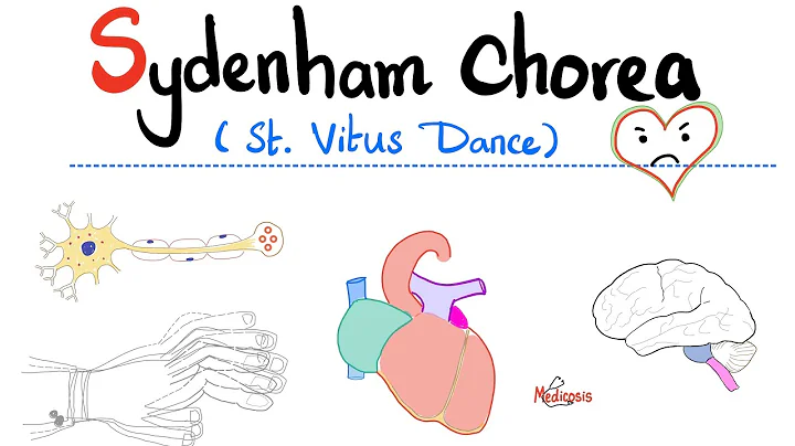 Sydenham Chorea (St. Vitus Dance) - Rheumatic Fever - Neurology & Cardiology - DayDayNews