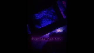 Polycephalylarge Tv Man Death Skibidi Toilet 79 Part 2 Leaks Edit