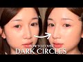 Cover your Dark Circles With This Method
