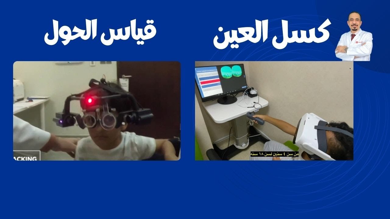 استخدام الكمبيوتر والتكنولوجيا في علاج الحول وكسل العين