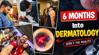 Information Life as a Dermatology Resident: Expectations vs Reality #dermatology#residency  News