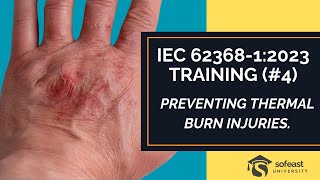 IEC 62368-1:2023 Training (Part 4: Preventing Thermal Burn Injuries)
