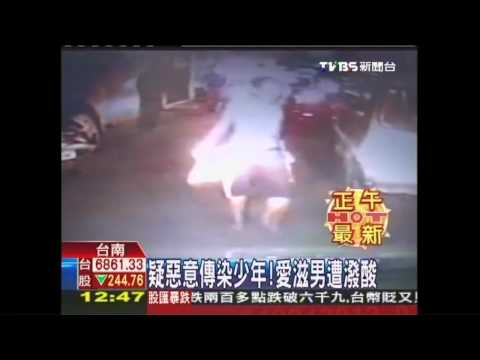 疑惡意傳染少年！　愛滋男遭潑酸