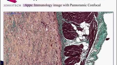 3DHISTECH - Digital pathology on the move: Pannoramic Confocal