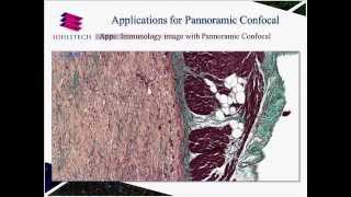 3DHISTECH - Digital pathology on the move: Pannoramic Confocal