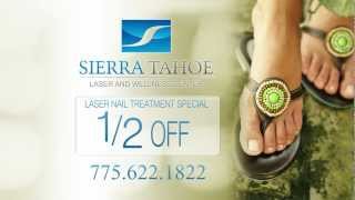 Sierra Tahoe Wellness Laser Nail Treatment