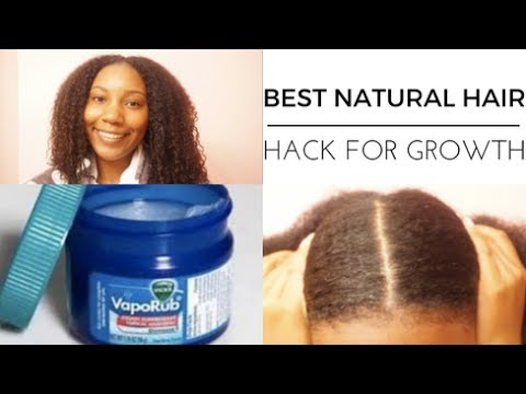 6 WEEK Vicks Vapor Rub HAIR GROWTH CHALLENGE Day1  YouTube