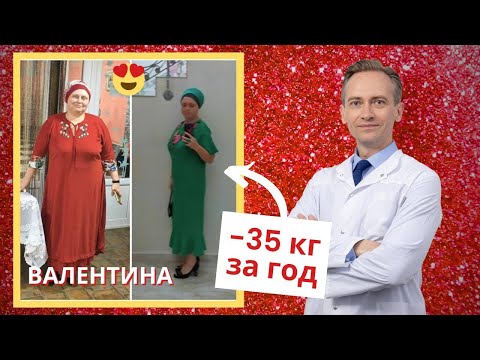 Валентина -35 кг за год. Как похудеть, если с детства склонен к полноте?