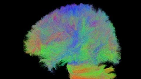 Brain Tractography - Structural Connectivity
