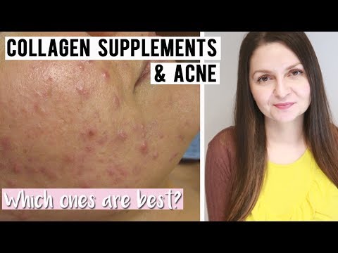 Best Collagen Supplements for Acne Prone Skin - Supplements for Clear Skin