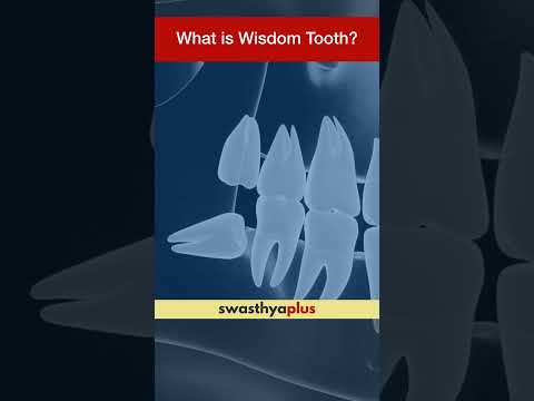 What is Wisdom Tooth? | Toothache | Dr Aman Bhimani | #Shorts