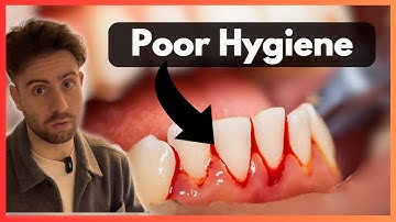 Bleeding Gums? Here