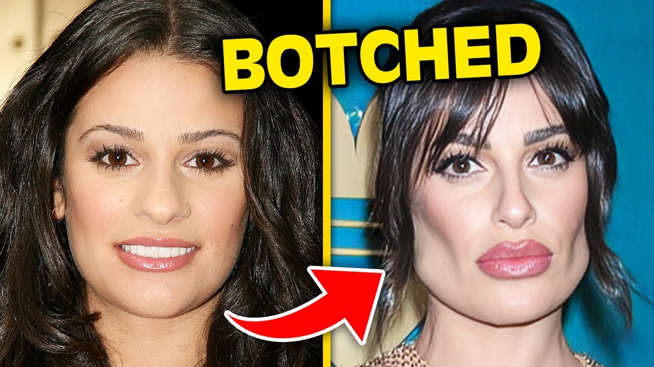 Top 10 Celebrities Who Destroyed Their Looks With BOTCHED Plastic Surgery