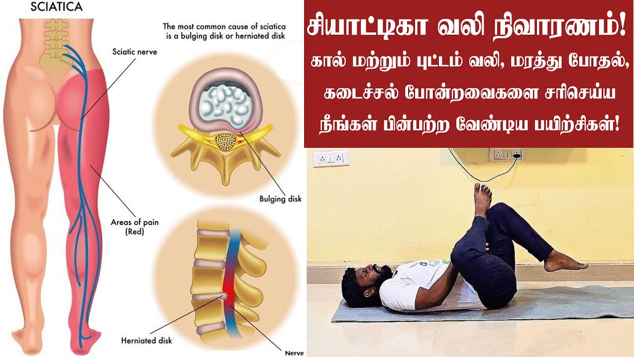 Sciatica சியாட்டிகா பிரச்சினையை சரி செய்யக்கூடிய சிறந்த யோகா ஆசனப் பயிற்சிகள்