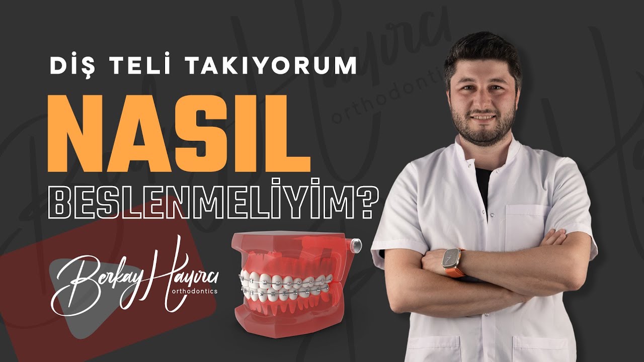 Diş Teli Yeme İçme - Uzm. Dt. Berkay Hayırcı