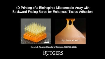 4D Printing of a Bio-inspired Microneedle with Backward-facing Barbs for Enhanced Tissue Adhesion
