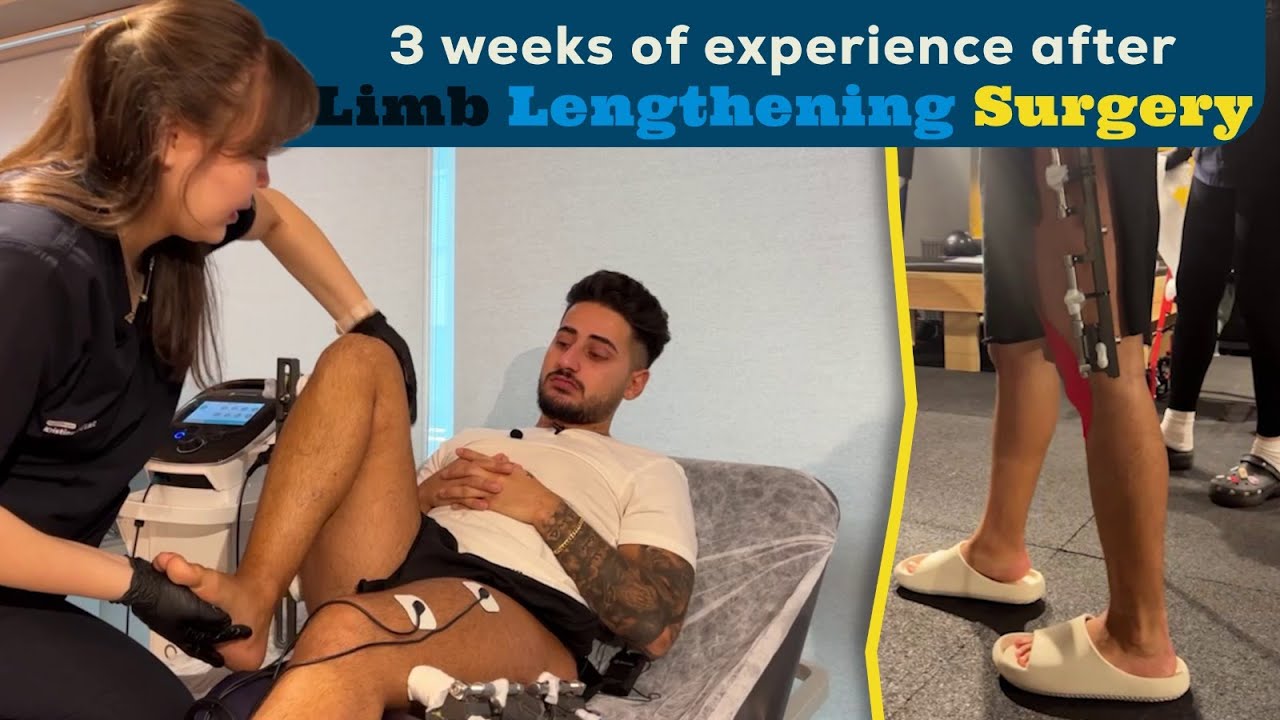 3 WEEKS OF EXPERIENCE AFTER LIMB LENGTHENING SURGERY - YouTube