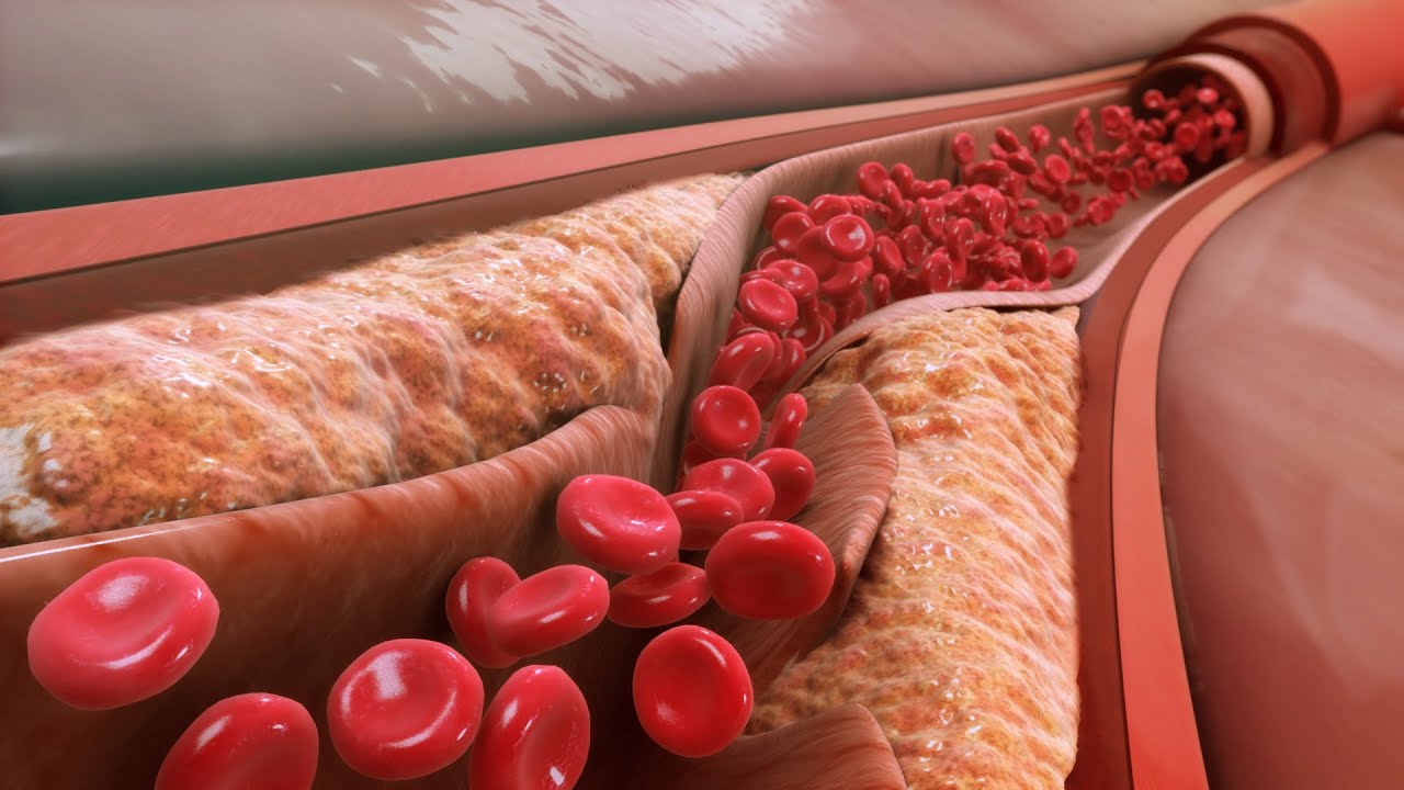 Cholesterol Pharmacology: Statins and More