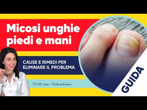 Video: Come prendersi cura dei piedi e delle unghie dei piedi (con immagini)