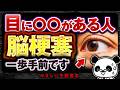 【放置厳禁】絶対知っておいてほしい!脳梗塞が近い人だけに起こる「目の異変」について解説(脳梗塞 危険なサイン)