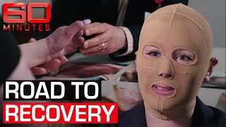 White Island volcano survivor's message to the heroes who saved her life | 60 Minutes Australia Profile