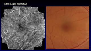 Motion-free imaging of vasculature and pigment by Lissajous polarization OCT