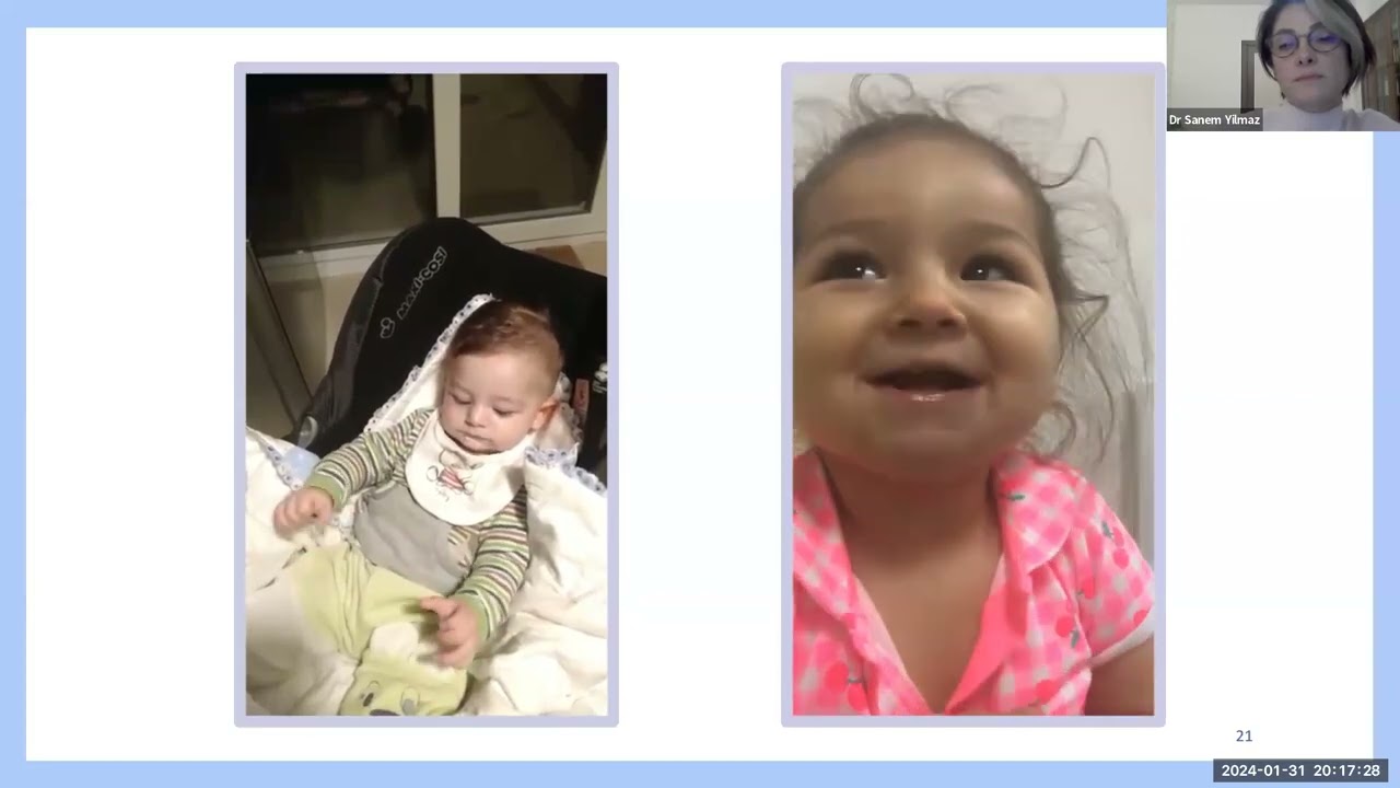 SIG Movement Disorders Session 5