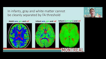 OHBM 2023 | 2734 | Educational Course | Tractometry | Part 9