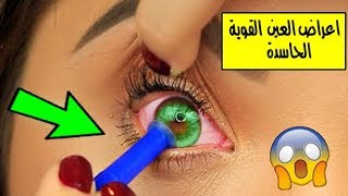 اعراض العين القوية الحاسدة! لن تصدق !!