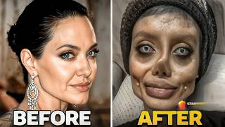 Famous Celebrities UNRECOGNIZABLE After Plastic Surgery Gone WRONG | Then and Now 2026