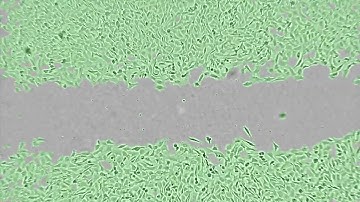 3T3 scratch assay (wound healing assay) time lapse - CytoSMART Lux2
