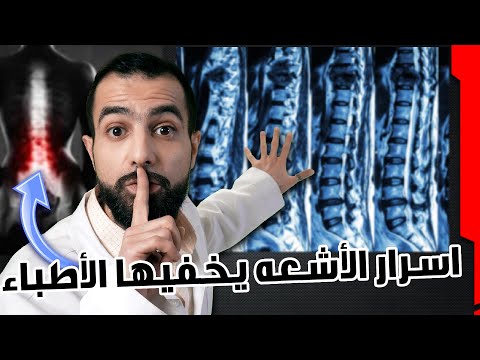 فيديو: ما هو اسم النهاية المائلة المسطحة على إبرة؟