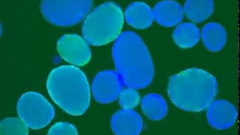 Pancreatic Islet Oscillations (Dr.Matthew Merrins Lab)
