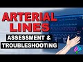 Arterial Lines Assessment and Troubleshooting Quiz