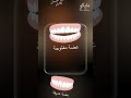 ابتسامتك المثالية تبدأ هنا | تقويم makeO الشفاف