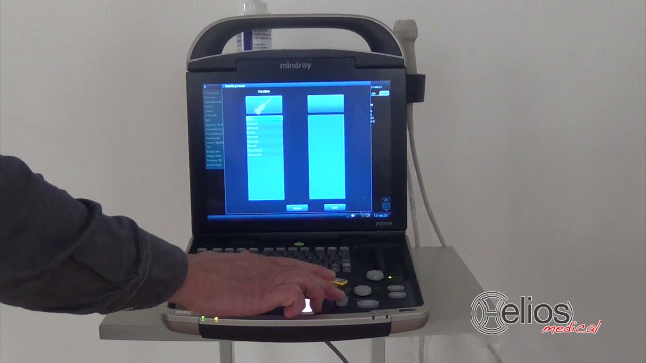 DP-30 de Mindray - Un ecógrafo a color, compacto, ligero y asequible