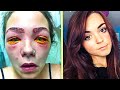 Teen Starts Going Blind, Realizes That Her Beauty Routine Is Deadly.!