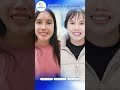 MOM STARTED SMILING MORE AFTER HER DENTAL CROWNS