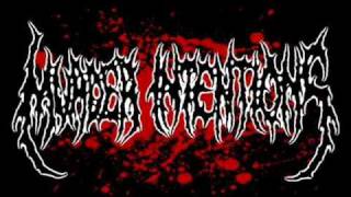 Murder Intentions - Corpse Explosion