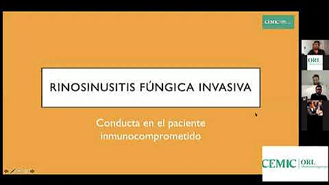 ¿Qué es la sinusitis fúngica?