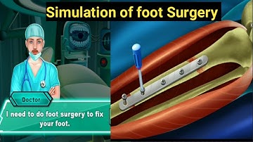 From Simulation to Real Life || How Foot Surgery Simulators are Enhancing Surgical Skills