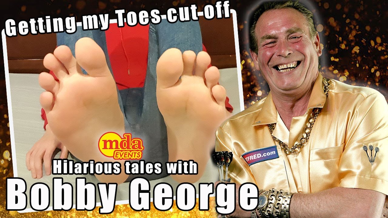 Why did Bobby George have his toes cut off?