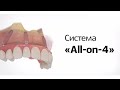 Технология тотального восстановления утраченных зубов "ALL-ON-4" или "все-на-четырех"