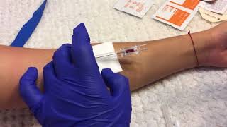 Starting a 20G Antecubital / Cephalic Vein IV